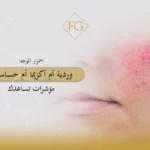 احمرار الوجه
