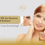 PDL vs IPL for Rosacea & Facial Redness: Which is Better?
